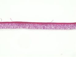epiCS® - menschliche Epidermis, rekonstruiert aus primären menschlichen Keratinocyten Quelle: Corporate Copyright: Fraunhofer ISC/TLZ-RT