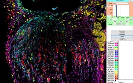 Fluoreszenzaufnahme von verschiedenen Immunzellen bei der Reparatur des verletzten Ischiasnerven.  © Fraunhofer IME