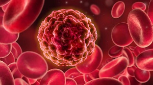 Krankheitsrückfälle treten in bis zu 30 % der Transplantatempfänger auf und tragen damit wesentlich zur Morbidität und Mortalität nach allogener, hämatopoetischer Stammzelltransplantation bei. Adobe Stock