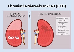 Chronische Nierenkrankheit