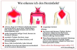Herzinfarkt-Schmerzorte  Illustration: Deutsche Herzstiftung