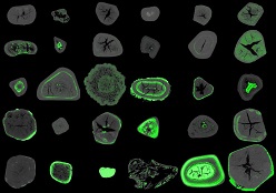 Menschliche Galleinsteine sind teilweise verkalkt und zeigen einen schalenförmigen Aufbau. (Bild: Daniela Weidner/Martin Herrmann) Bild: Daniela Weidner/Martin Herrmann