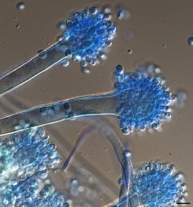 Mikroskopische Aufnahme eines typischen Schimmelpilzes in Orgeln: Aspergillus glaucus in 600-facher Vergrößerung.  Bildquelle: IHD