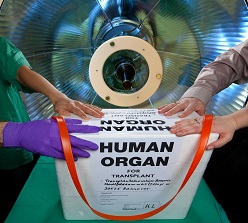 Symbolbild Organspende der MHH  MHH-Archiv (Bodo Kremmin)