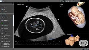 Trainingsmodus: Die Vermessung des Herzens mittels Ultraschall kann mit dem Simulator geübt werden  (Foto: HDZ NRW).