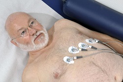 Mittels EKG kann bei Patienten ein bestehendes Vorhofflimmern nachgewiesen werden.  Bild: AFNET