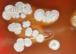 Eine Bakterienkolonie des Melioidose-Erregers Burkholderia pseudomallei. Der abgebildete Erreger wurde vom InfectoGnostics-Forscher Stefan Monecke aus einer Probe eines deutschen Reiserückkehrers aus Asien isoliert.  Stefan Monecke  JMM Case Reports, doi: 10.1099/jmmcr.0.000073