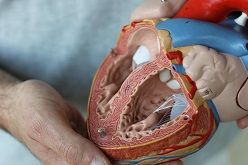 Die Spende von Herzklappen ist noch bis zu 36 Stunden nach dem Herz-Kreislauf-Tod möglich. In 2020 konnte die DGFG 38 solcher Spenden realisieren.  DGFG