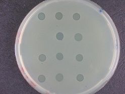 Bakterienrasen mit Löchern, die durch Phagen verursacht werden  DSMZ