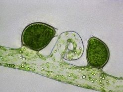 Die Schlauchalge Vaucheria bursata gilt in Deutschland als ungefährdet  Dr. Karl-Heinz Linne von Berg