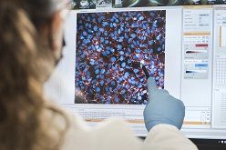 Analyse von Blut-Hirn-Schranken-Modellen basierend auf pluripotenten Stammzellen nach einer Infektion mit dem SARS-CoV-2-Erreger.  Martin Kunze  Fraunhofer ITMP