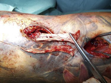 Verletzungen im Kraft und Ausdauersport Symbolbild