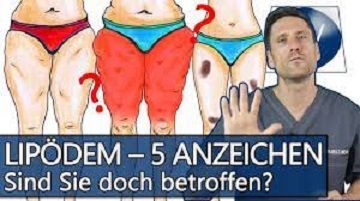 Lipödem  Symptome Symbolbild