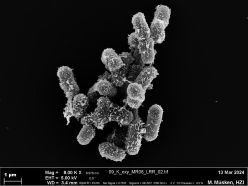 Elektronenmikroskopische Aufnahme von Klebsiella oxytoca  Quelle: Mathias Müsken  Copyright: HZI/
